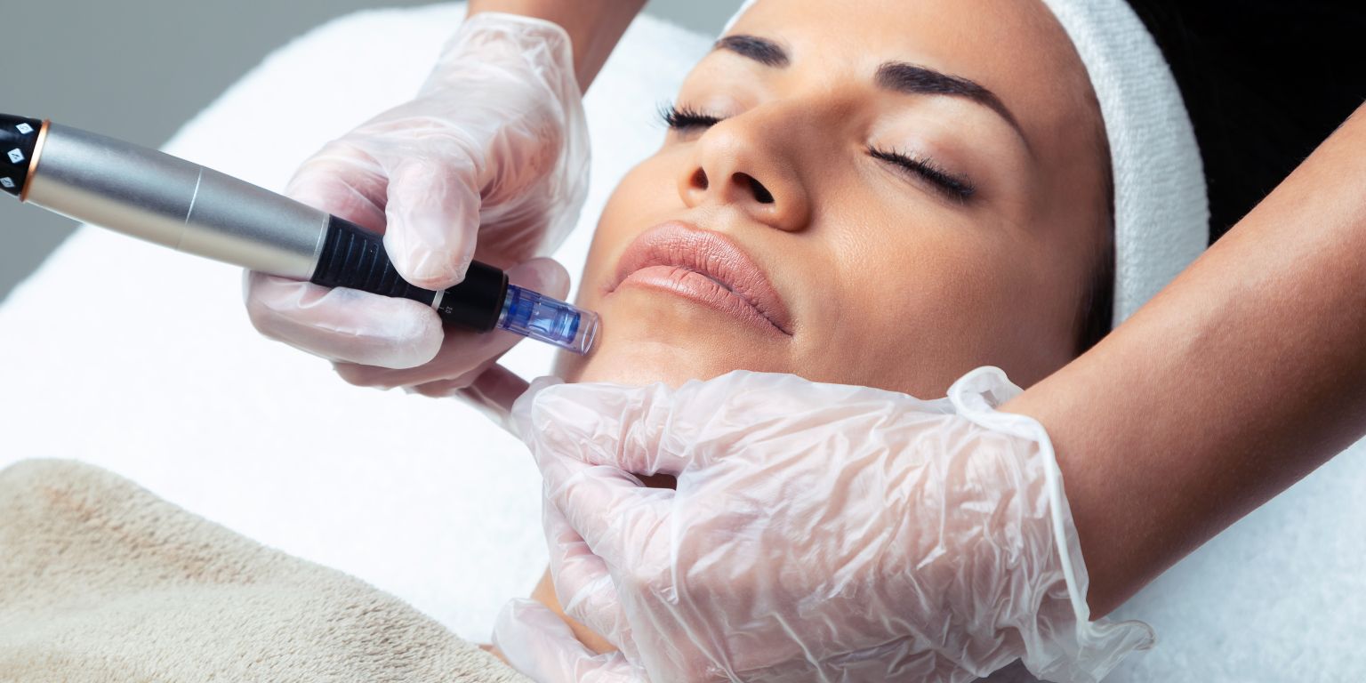 Microneedling