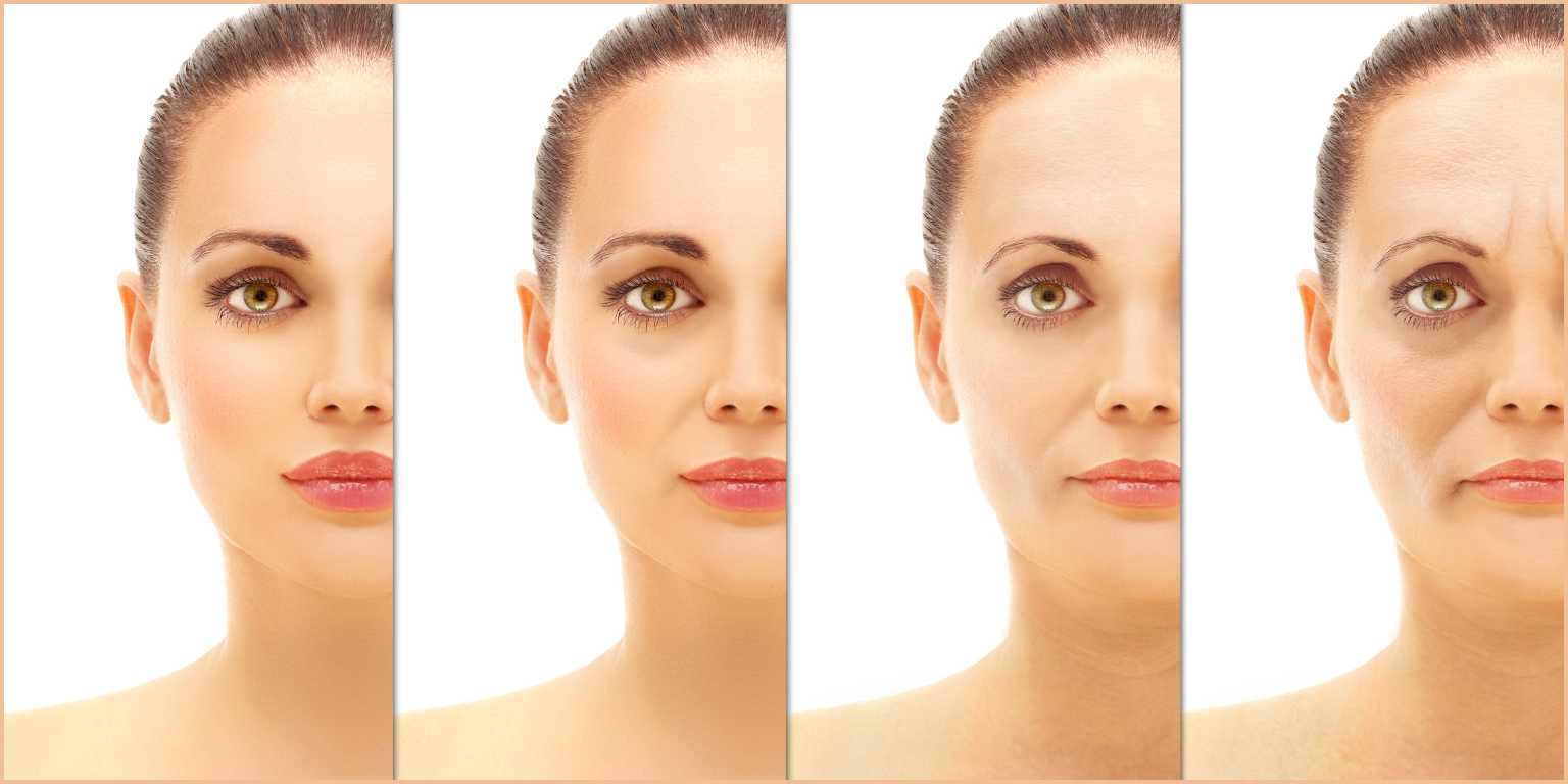 Understanding Fine Lines and Wrinkle