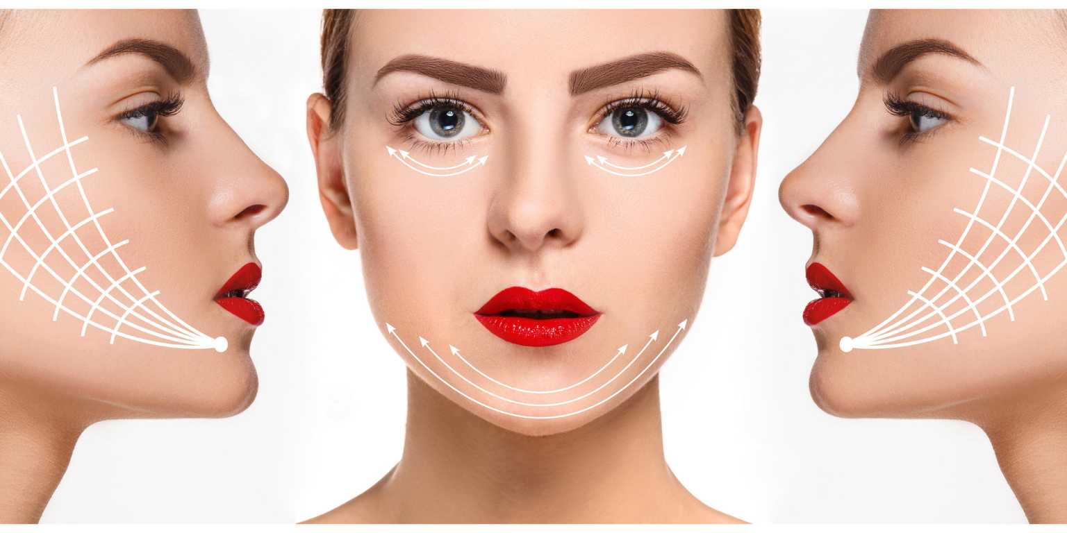 Target Areas for Facial Rejuvenation